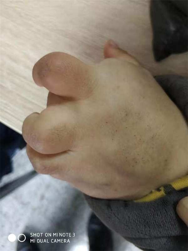 疑难杂症